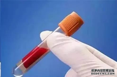 大连开发区拜城县药物流产前需要做哪些检查
